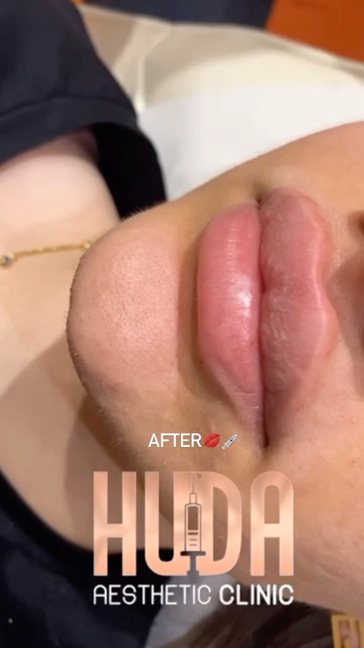 Post 5 by REBRANDED 👇🏻💉 PHANTOM MEDICAL GROUP on Instagram (video)