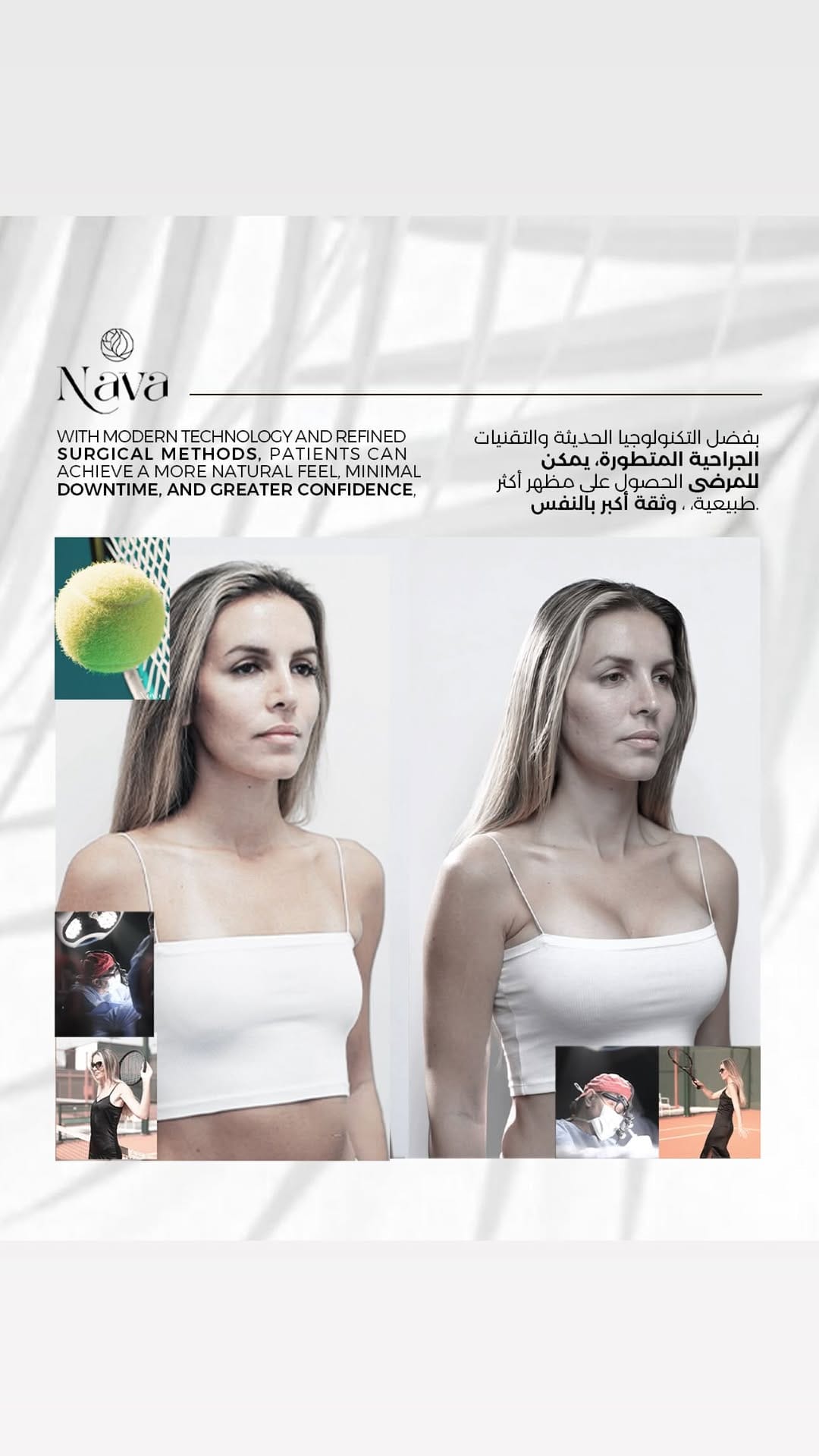 Post 10 by Nava Clinics on Instagram (video)