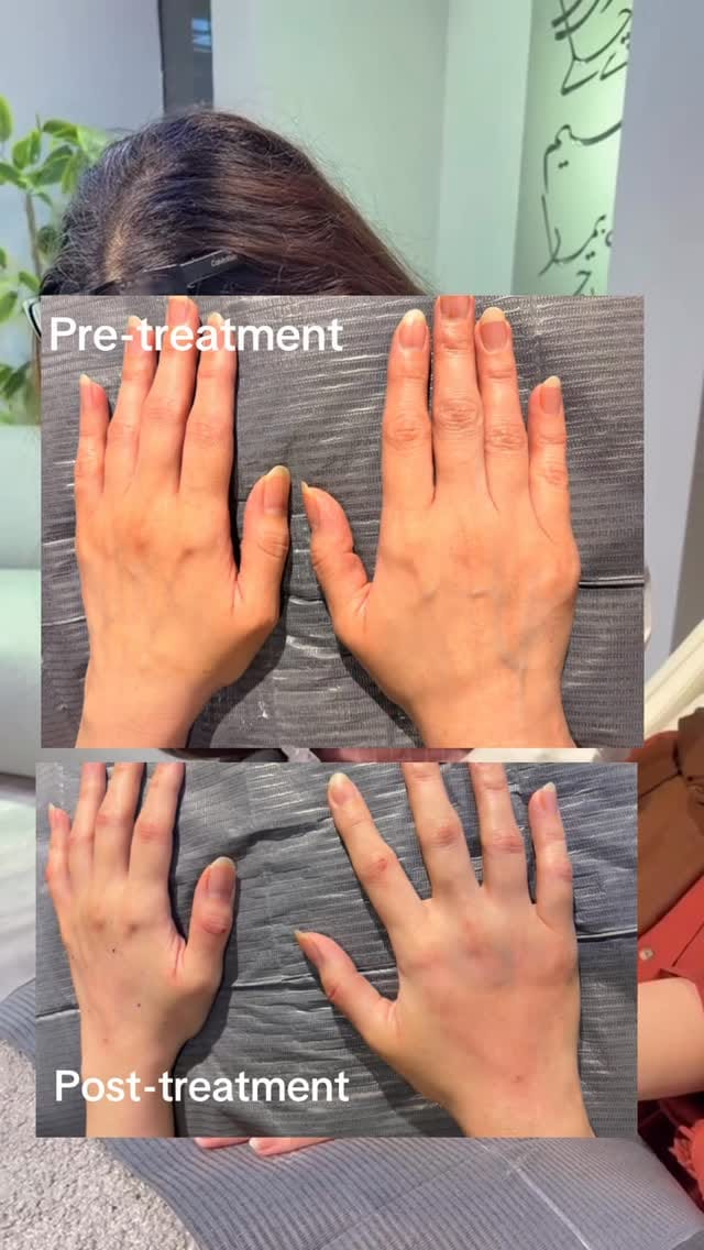Post 4 by Skin Coach by Dr. AJ on Instagram (video)