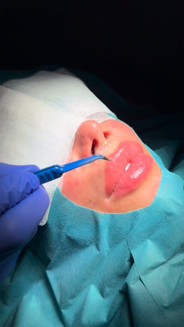 Post 4 by Dr. Fabian Ardame on Instagram (video)