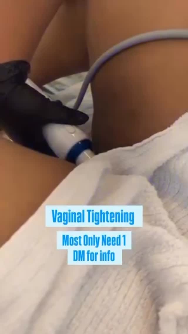 Post 8 by Philadelphia Area Body Contouring|Fat Loss|Training Academy on Instagram (video)