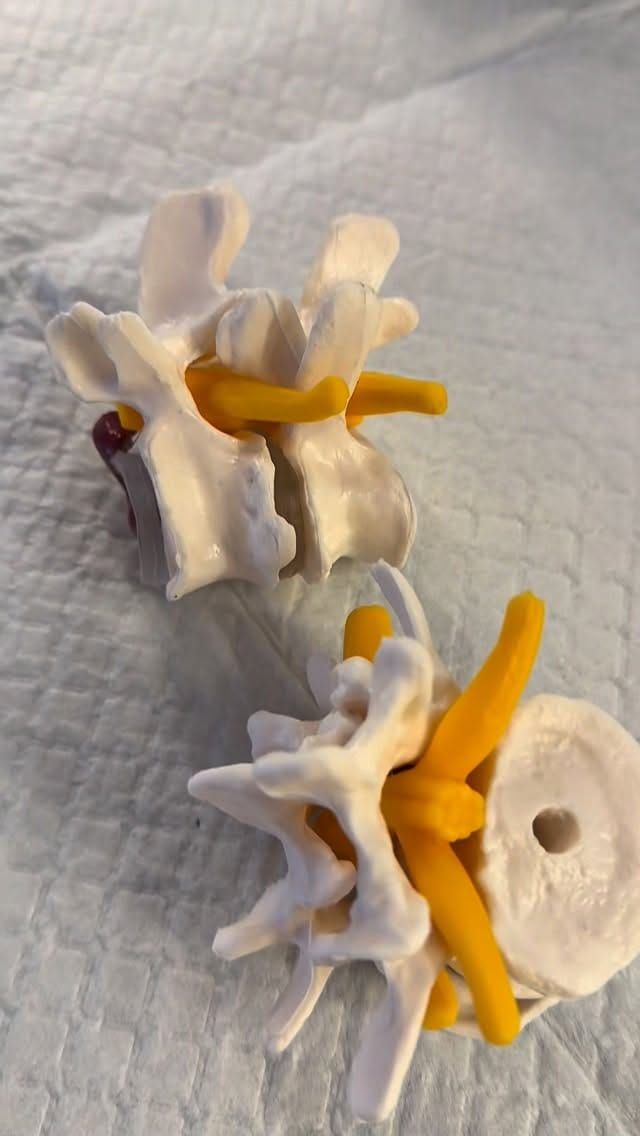 Post 2 by DR. AHMAD EL MASRI MD on Instagram (video)