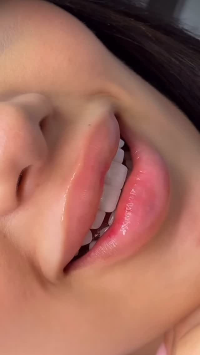 Post 8 by 𝑫𝒓. 𝑭𝒂𝒓𝒂𝒛 𝑵. 𝑲𝒉𝒂𝒏𝒊 on Instagram (video)