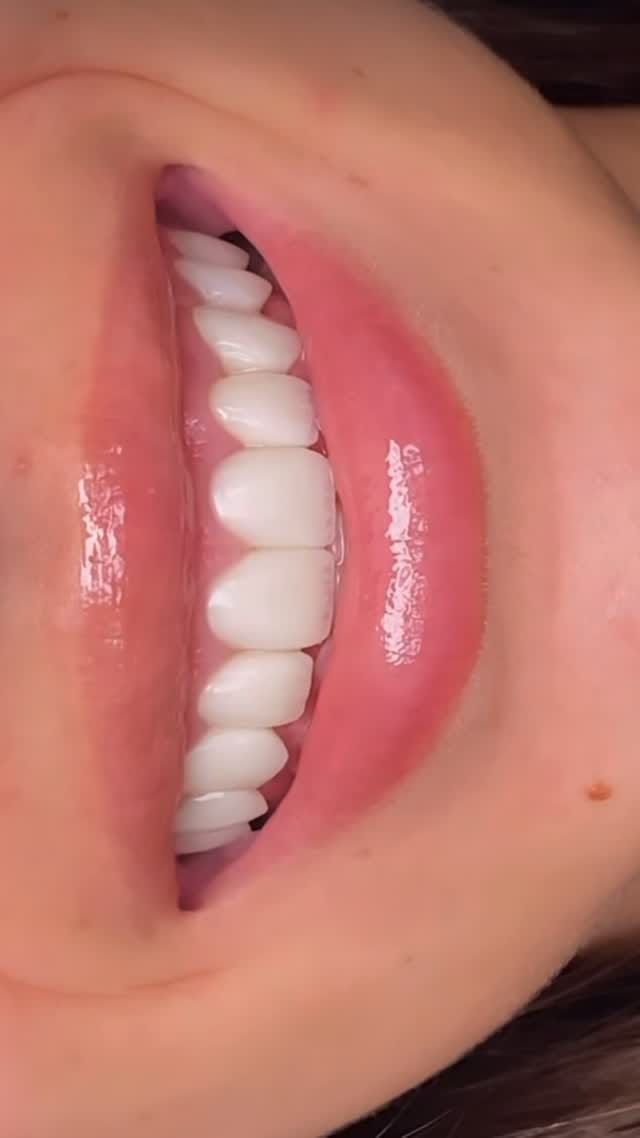 Post 10 by 𝑫𝒓. 𝑭𝒂𝒓𝒂𝒛 𝑵. 𝑲𝒉𝒂𝒏𝒊 on Instagram (video)
