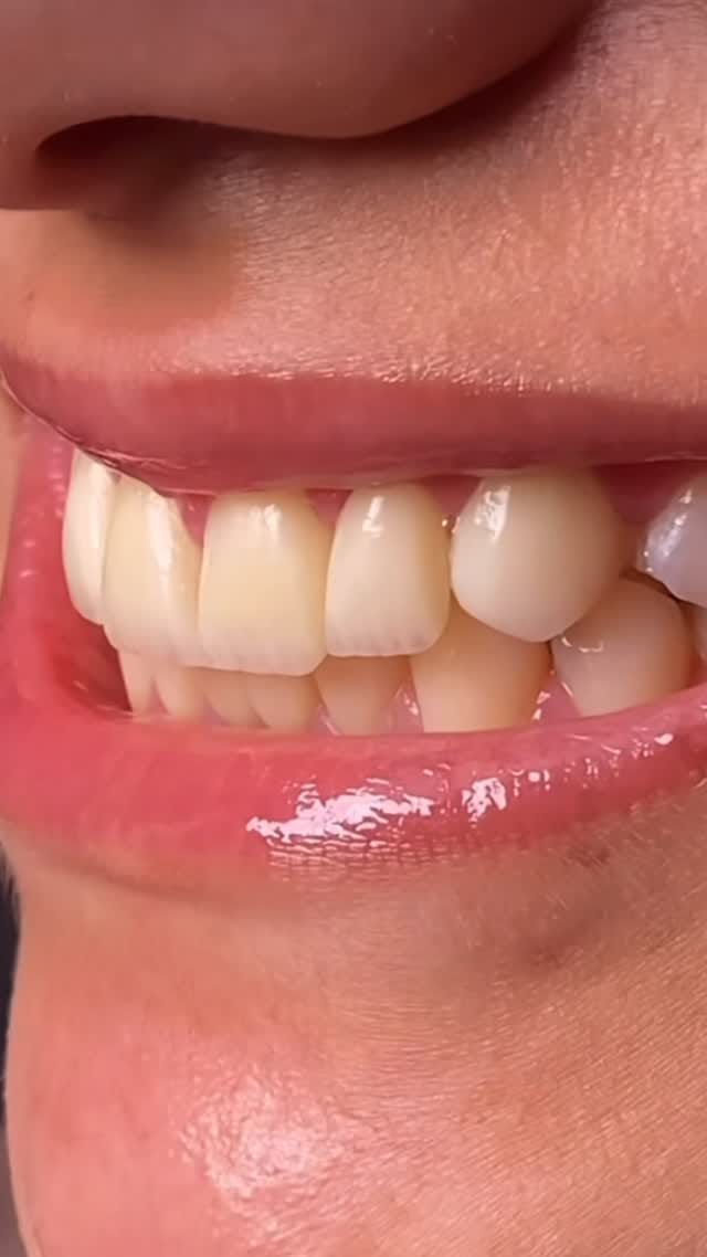 Post 9 by 𝑫𝒓. 𝑭𝒂𝒓𝒂𝒛 𝑵. 𝑲𝒉𝒂𝒏𝒊 on Instagram (video)