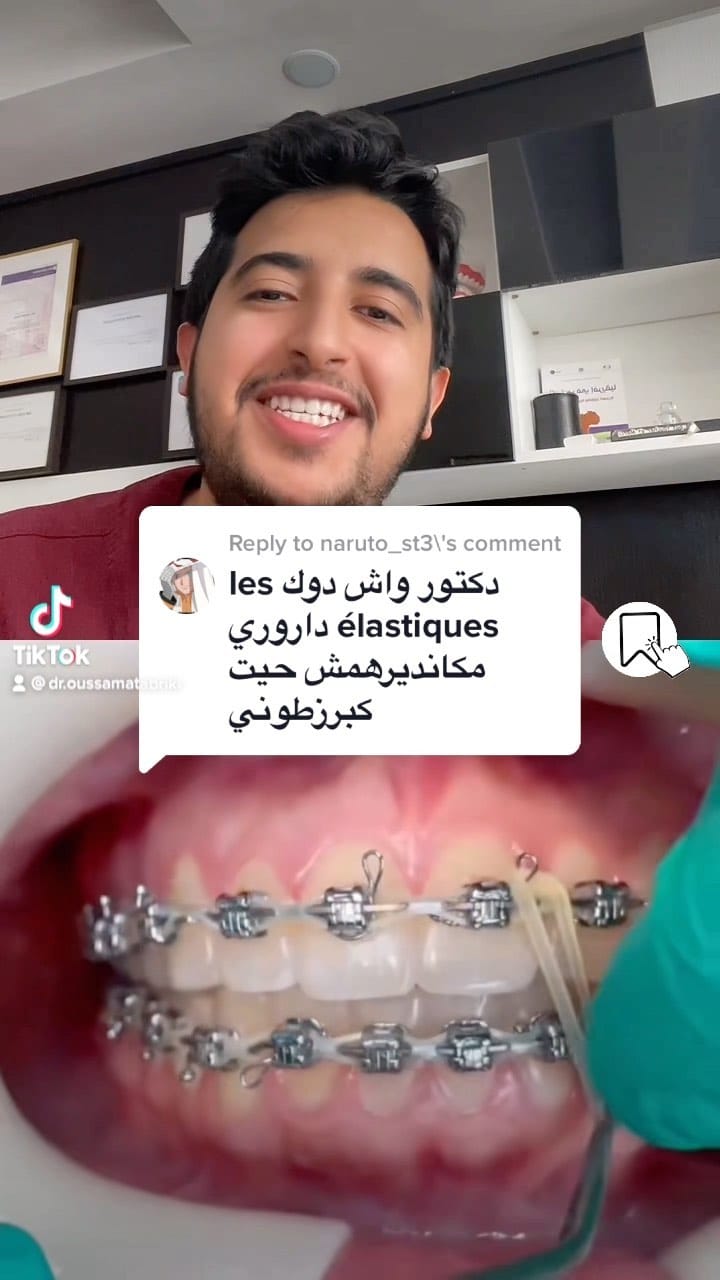 Post 4 by Dr Oussama Tabriki on Instagram (video)
