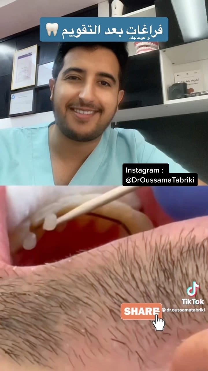 Post 5 by Dr Oussama Tabriki on Instagram (video)