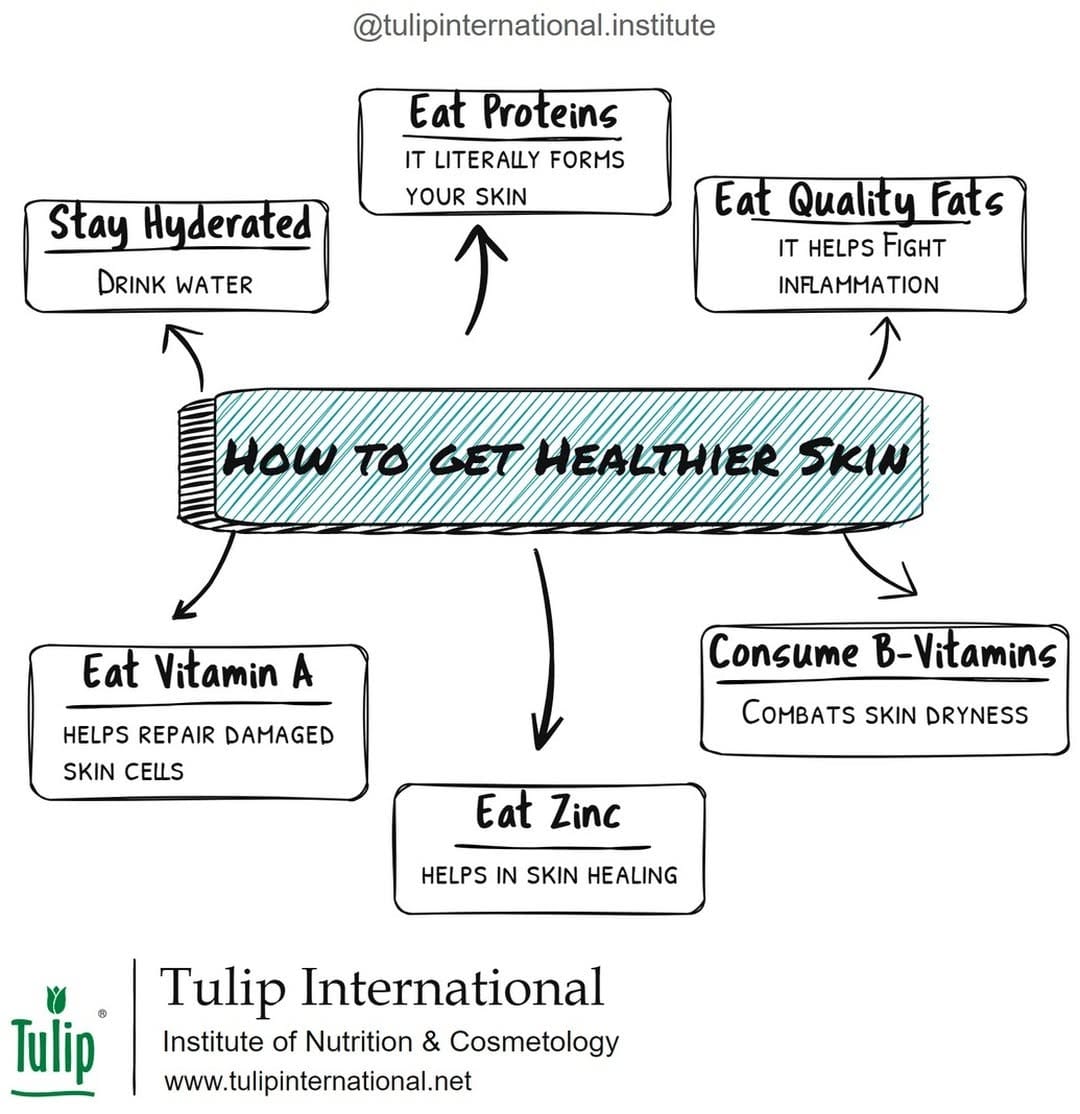Post 9 by Tulip International on Instagram (image)
