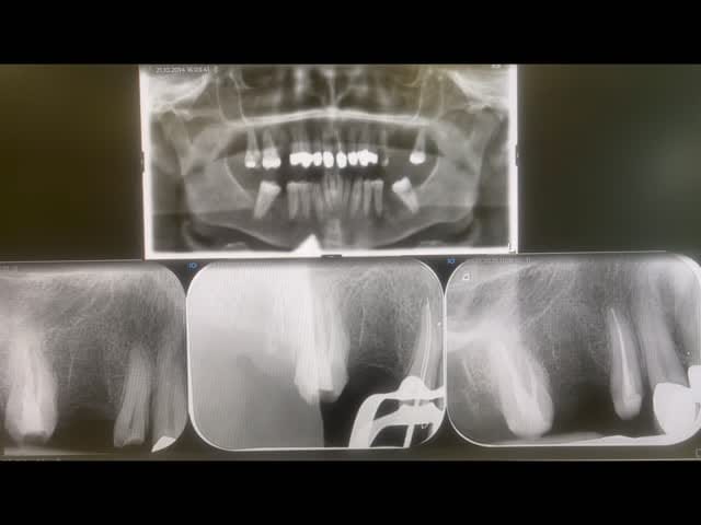 Post 1 by Dr. med. dent. Hayim M.Sc M.Sc on Instagram (video)
