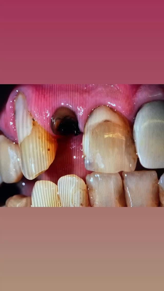 Post 5 by Dr. med. dent. Hayim M.Sc M.Sc on Instagram (video)