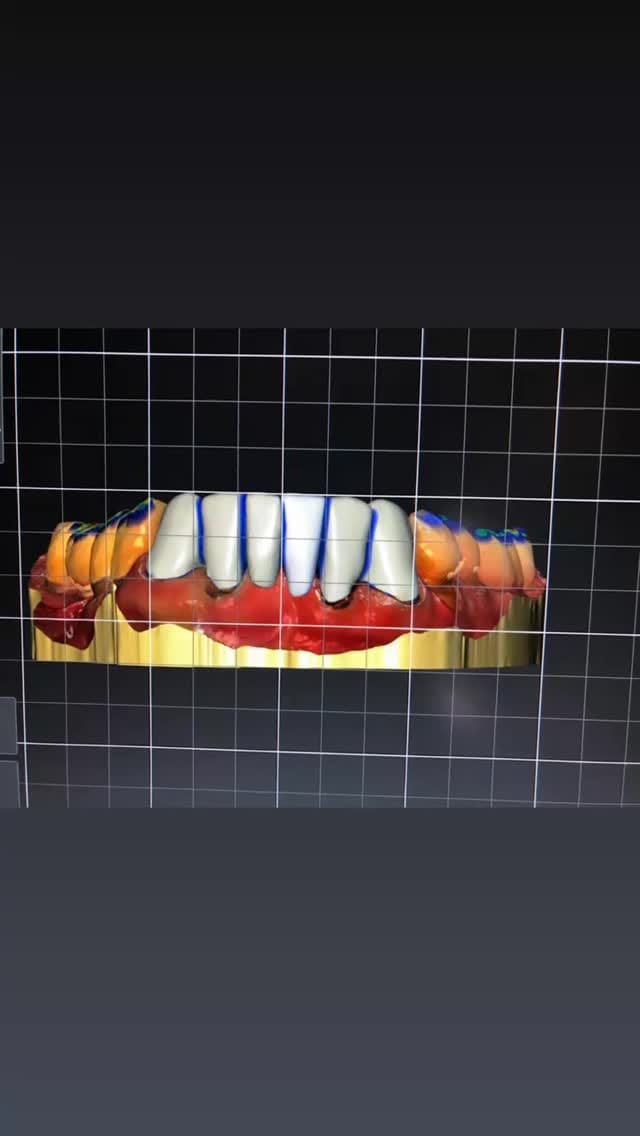 Post 3 by Dr. med. dent. Hayim M.Sc M.Sc on Instagram (video)