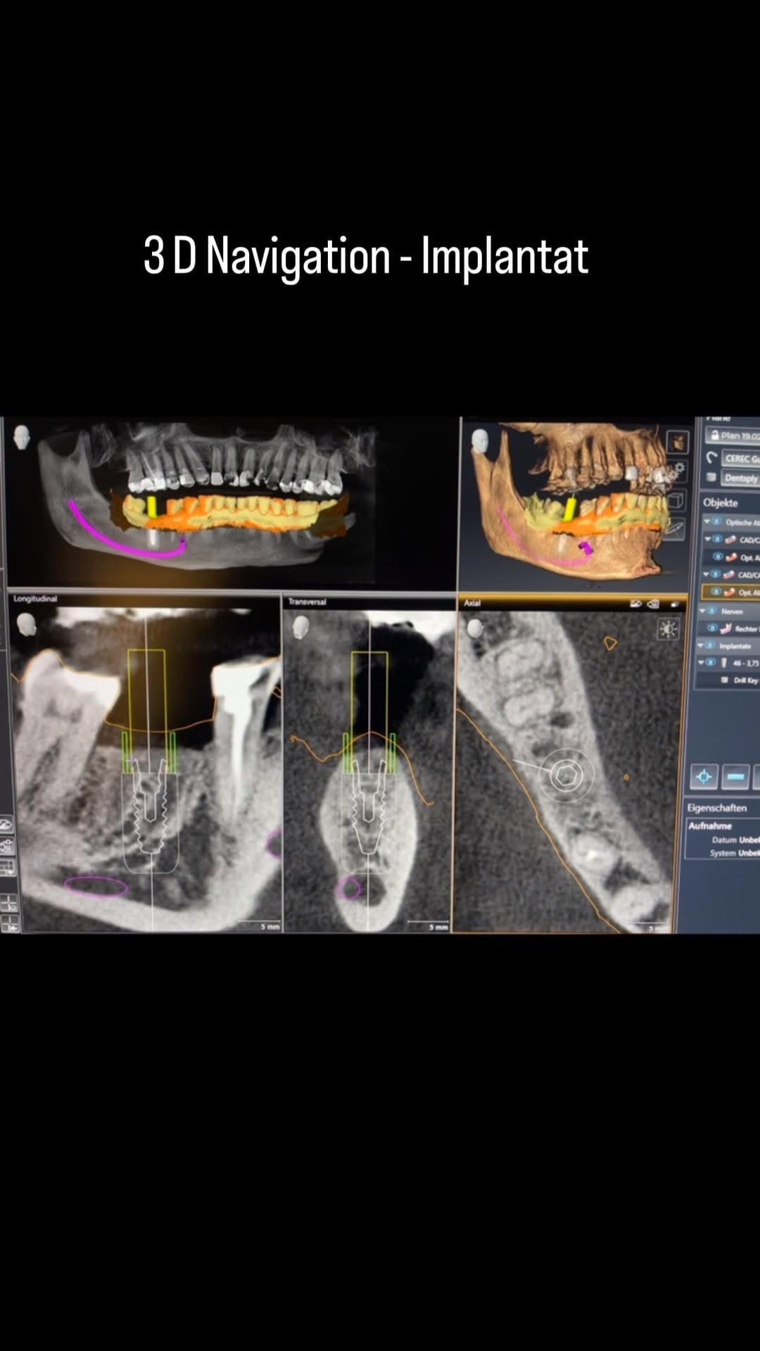 Post 9 by Dr. med. dent. Hayim M.Sc M.Sc on Instagram (video)