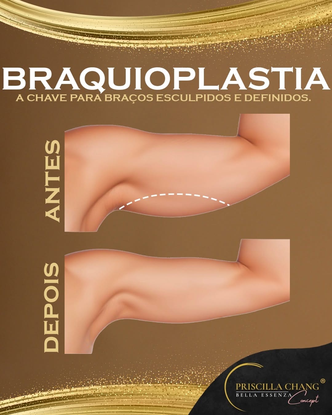 Post 1 by Lipo HD UGRAFT | Mama R24R | Priscilla Chang | Plástica | Manaus on Instagram (image)