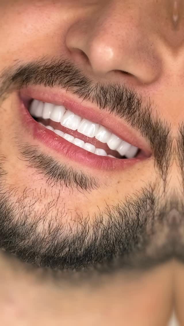 Post 7 by Elit Dental Türkiye on Instagram (video)