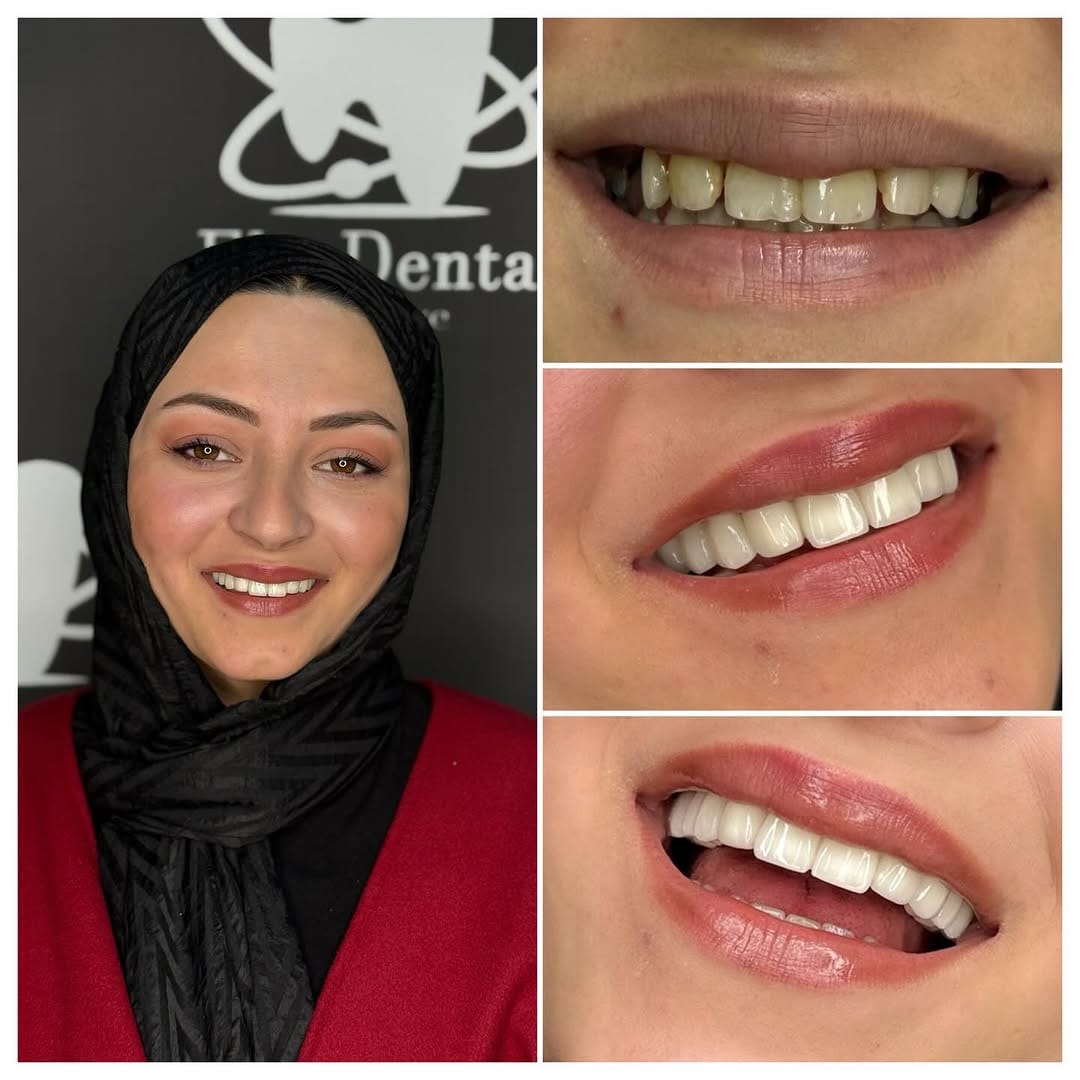 Post 6 by Elit Dental Türkiye on Instagram (image)