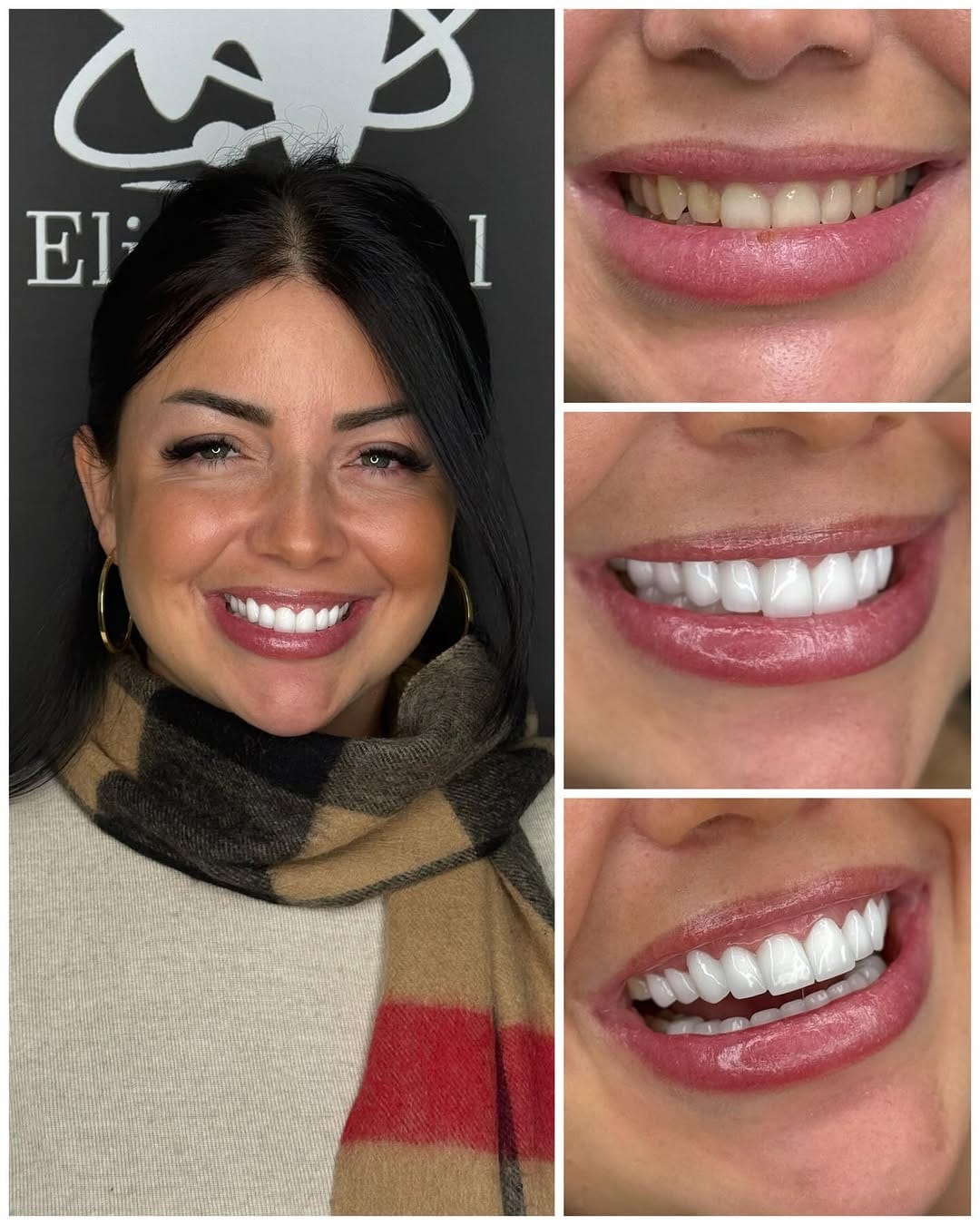 Post 3 by Elit Dental Türkiye on Instagram (image)