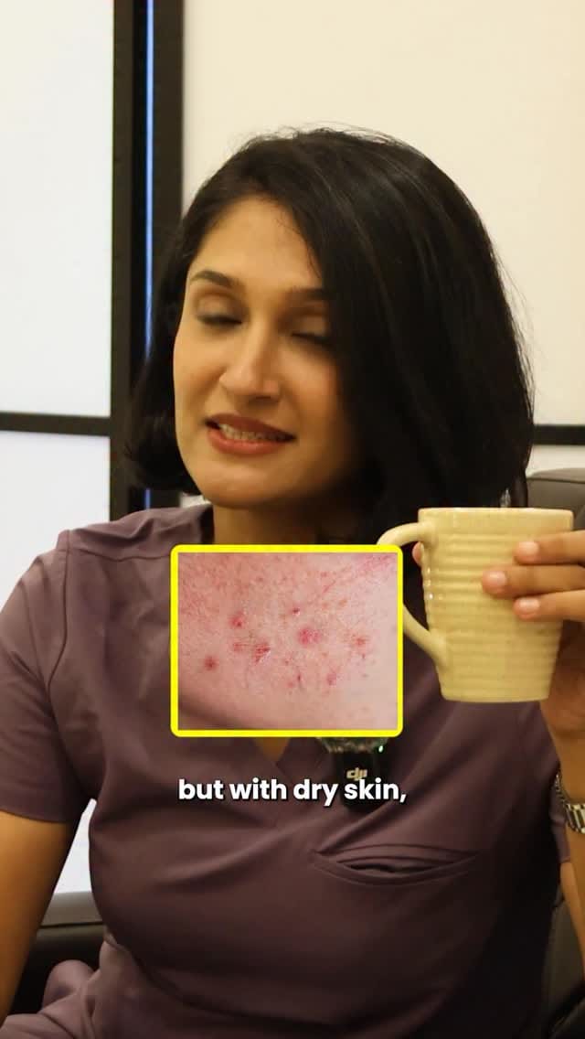 Post 2 by Dr. Tanvi Vaidya | MBBS MD DVL on Instagram (video)