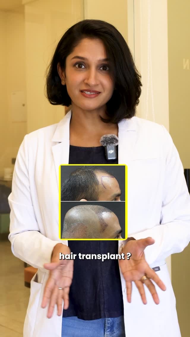 Post 7 by Dr. Tanvi Vaidya | MBBS MD DVL on Instagram (video)