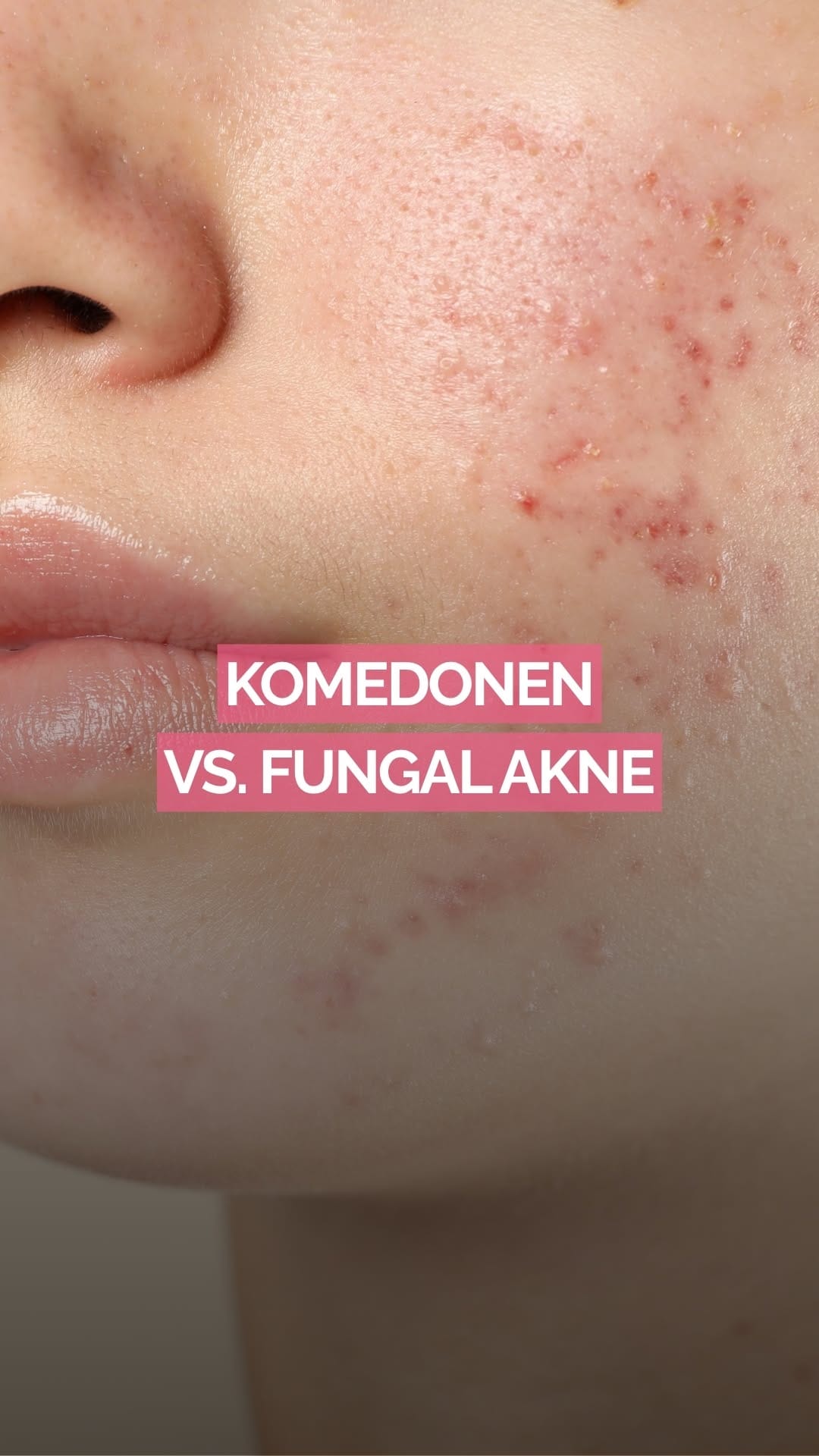 Post 9 by Dr. MEK | Dr. M. Erdmann-Keding on Instagram (video)