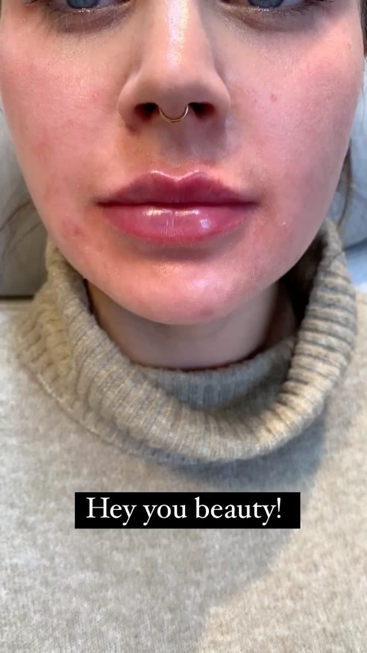 Post 10 by Med. Doctor  Büsra Ak on Instagram (video)