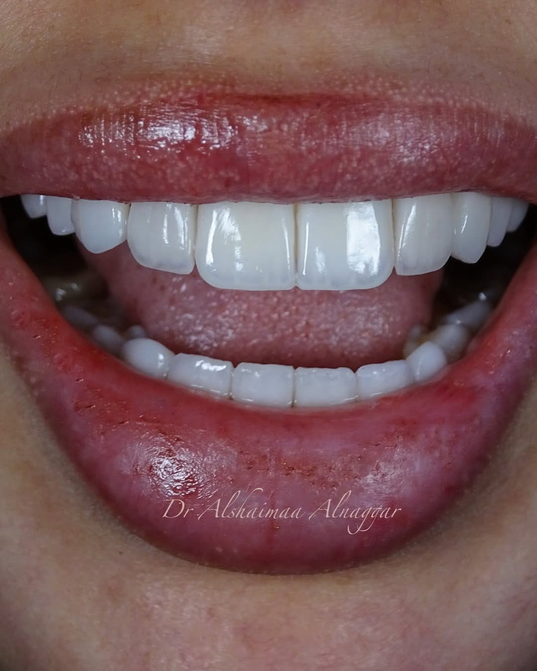 Post 8 by Dr Alshaimaa Alnaggar (Dentist Bahrain طبيبة اسنان البحرين ) on Instagram (carousel)
