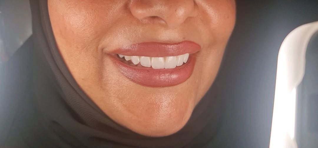 Post 9 by Dr Alshaimaa Alnaggar (Dentist Bahrain طبيبة اسنان البحرين ) on Instagram (video)