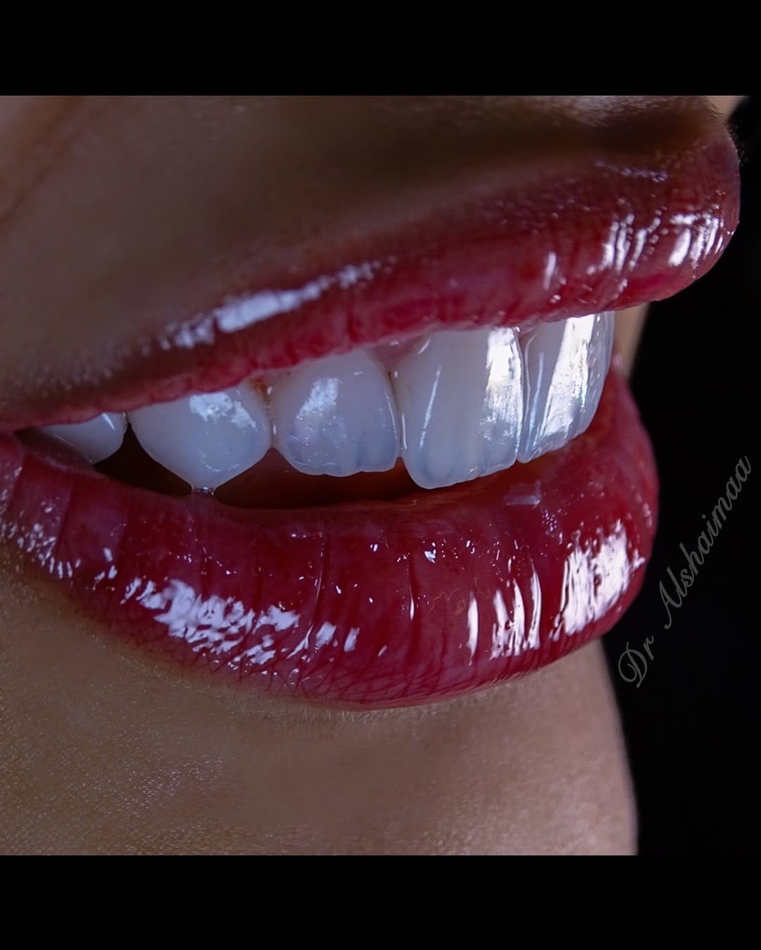 Post 7 by Dr Alshaimaa Alnaggar (Dentist Bahrain طبيبة اسنان البحرين ) on Instagram (carousel)