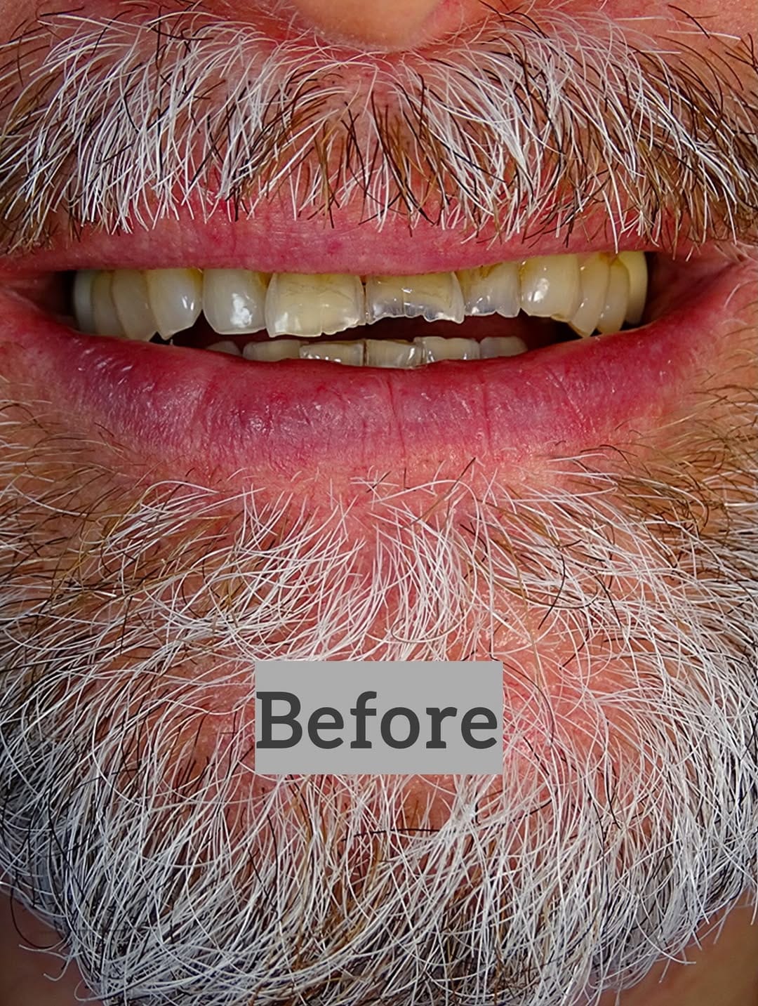 Post 5 by Dr Alshaimaa Alnaggar (Dentist Bahrain طبيبة اسنان البحرين ) on Instagram (carousel)