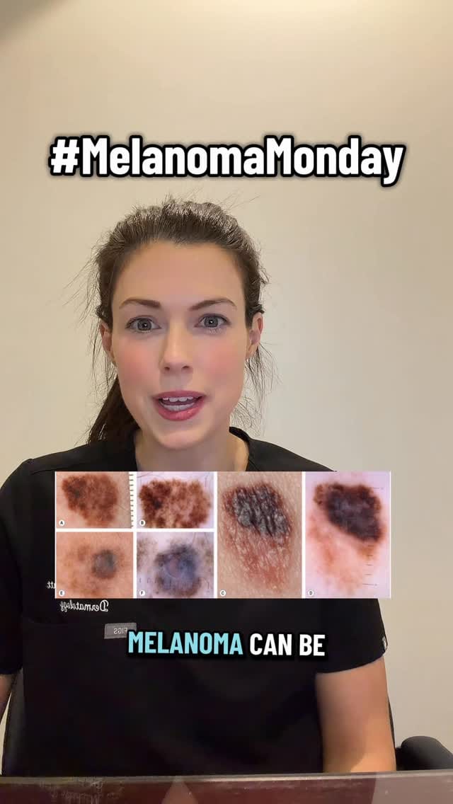 Post 2 by Michelle Pratt MD FRCPC DABD on Instagram (video)