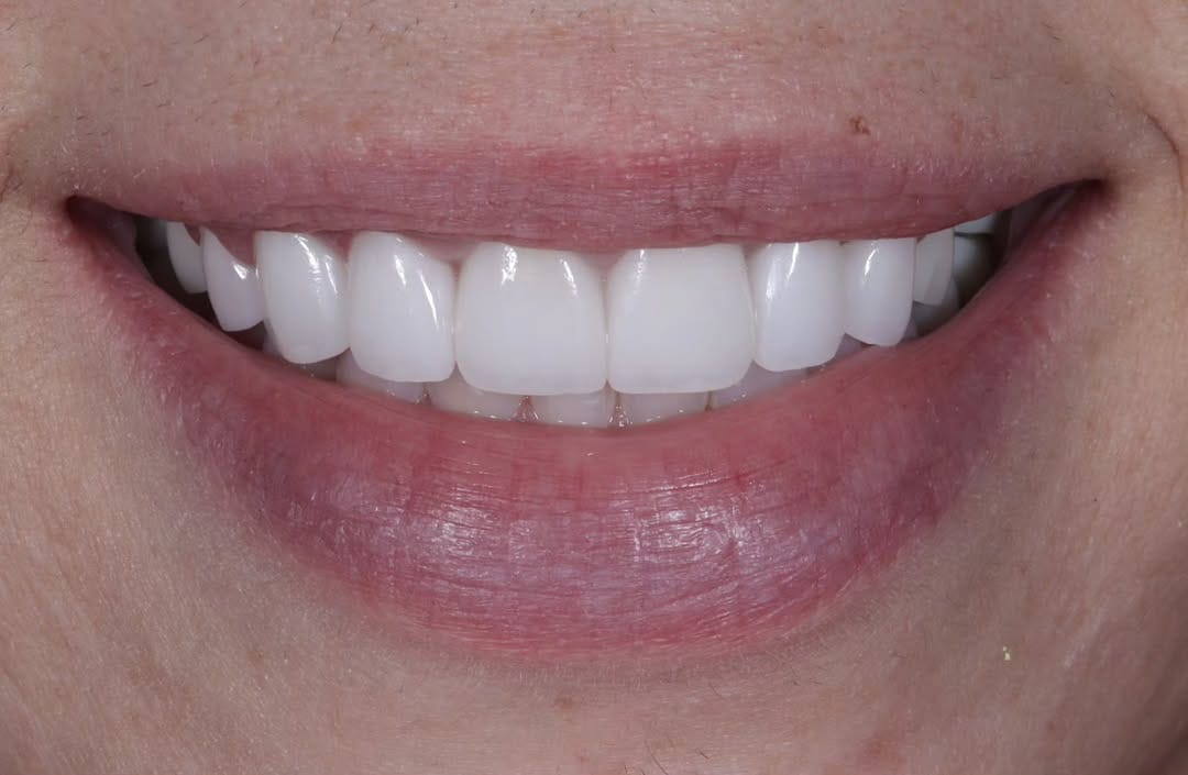 Post 3 by Dr. Joseph Goodman DDS DMD on Instagram (image)