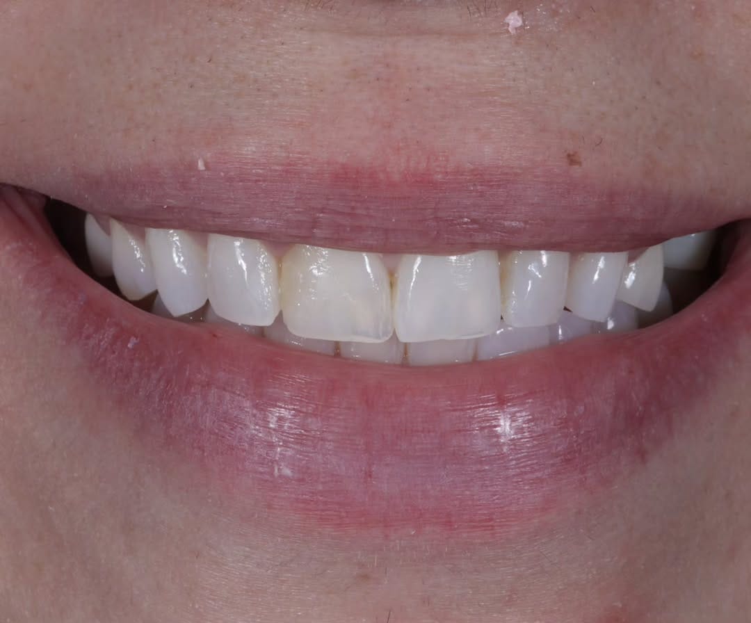 Post 4 by Dr. Joseph Goodman DDS DMD on Instagram (image)