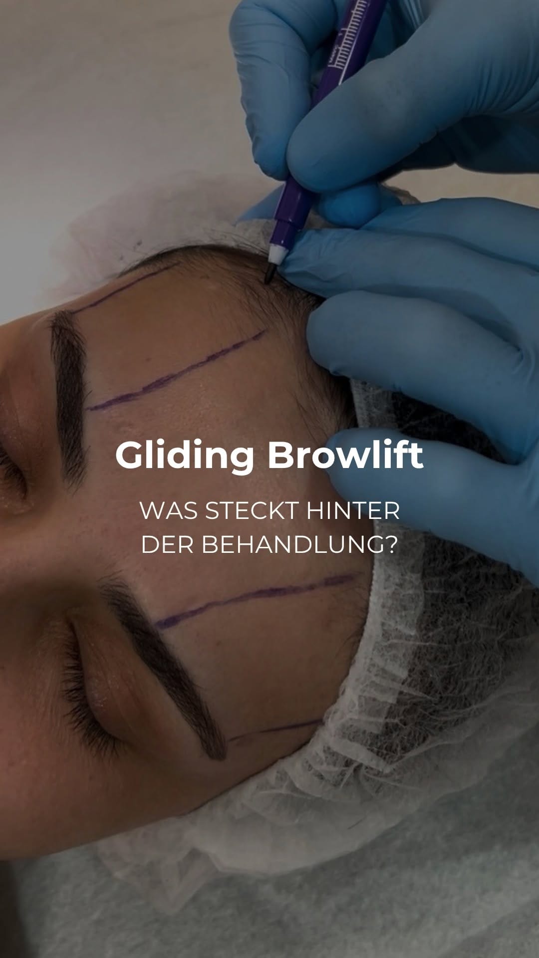 Post 1 by Dr. med. Ricarda Granes on Instagram (video)