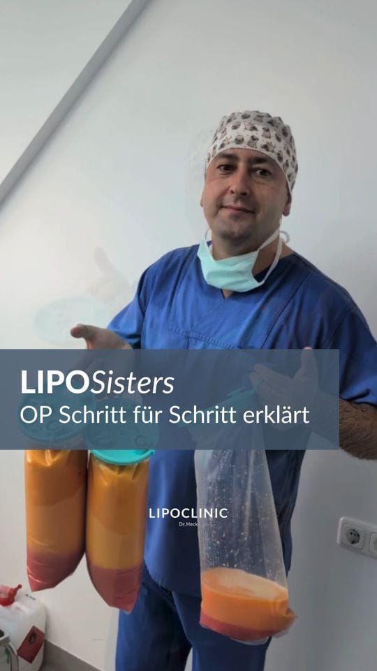 Post 4 by LIPOCLINIC Dr. Heck - Deine Lipödem Experten on Instagram (video)