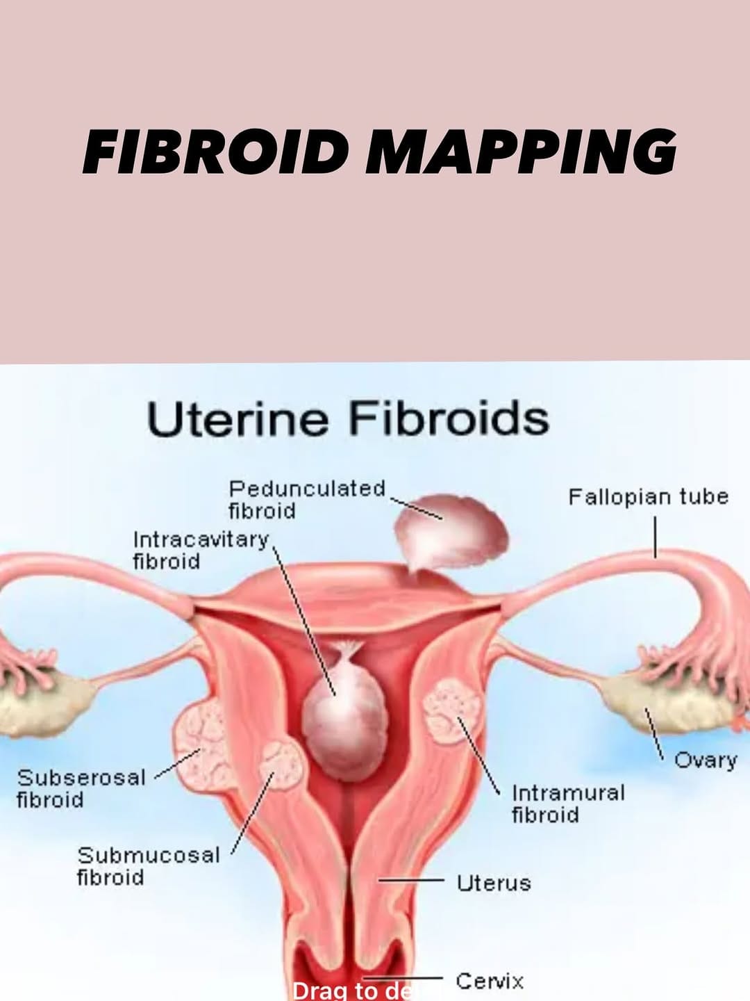 Post 4 by Dr Neha Goel Virk ( Infertility Expert) on Instagram (carousel)