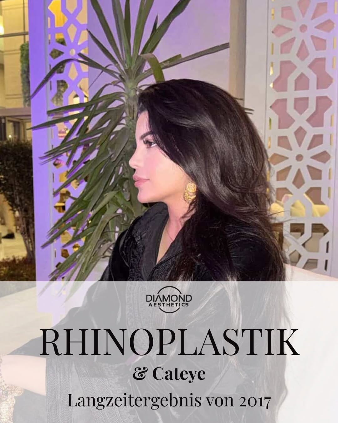 Post 2 by Diamond Aesthetics Klinik on Instagram (carousel)