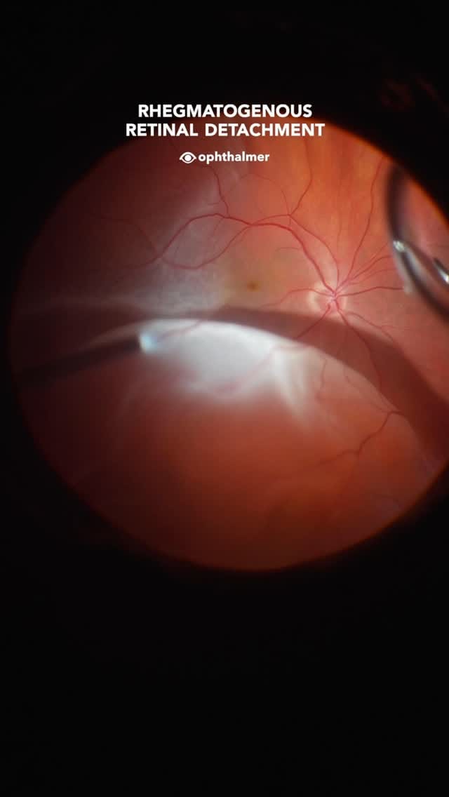 Post 6 by Custom Surgical on Instagram (video)