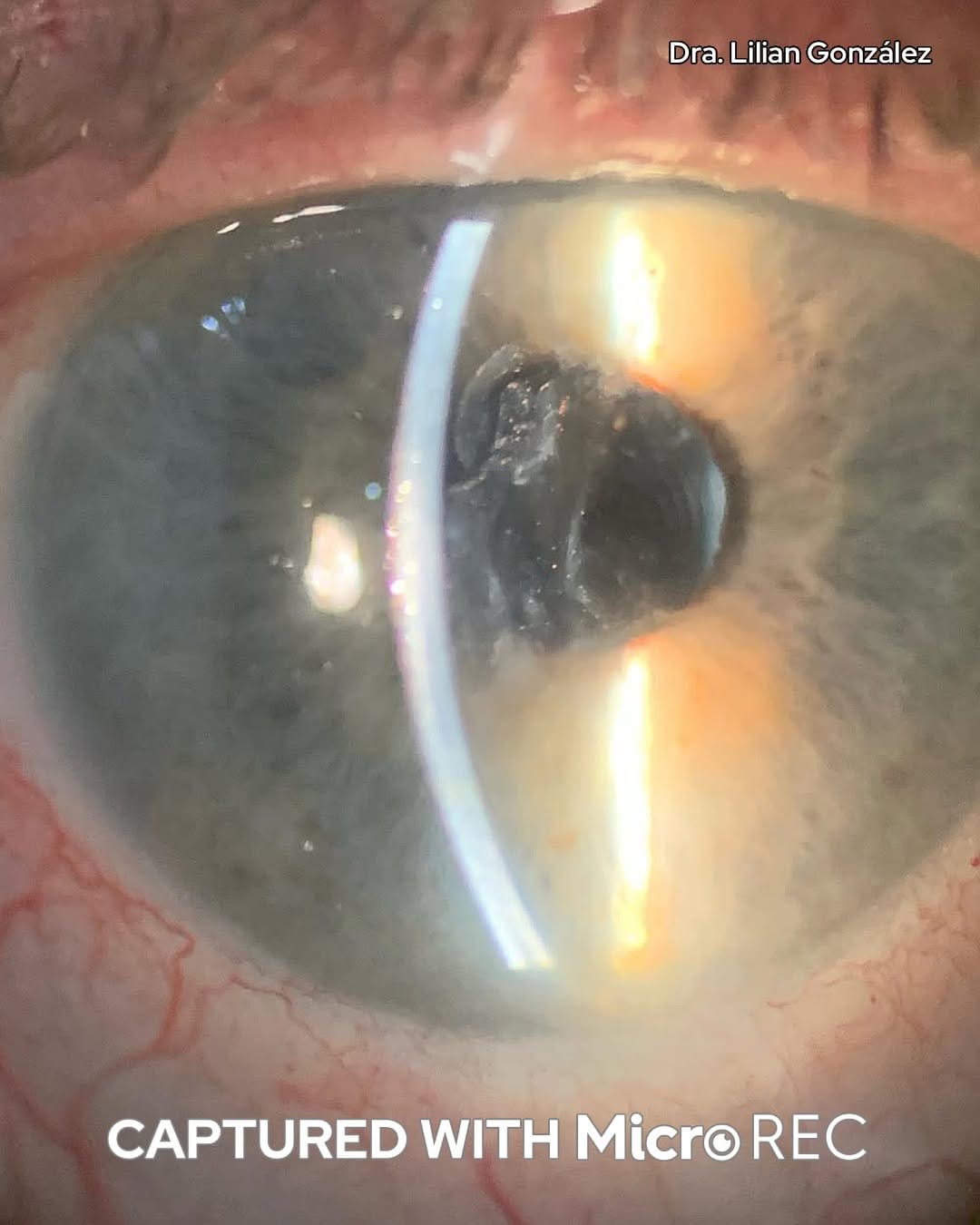 Post 7 by Custom Surgical on Instagram (carousel)