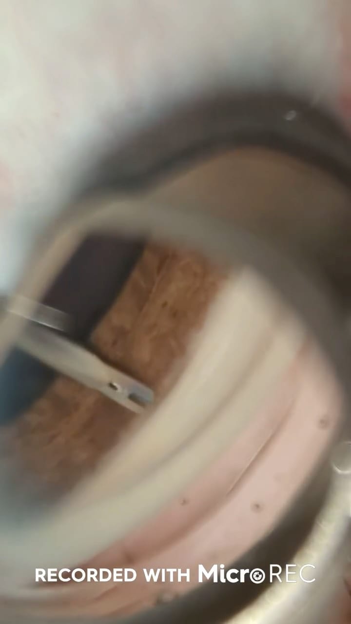 Post 1 by Custom Surgical on Instagram (video)