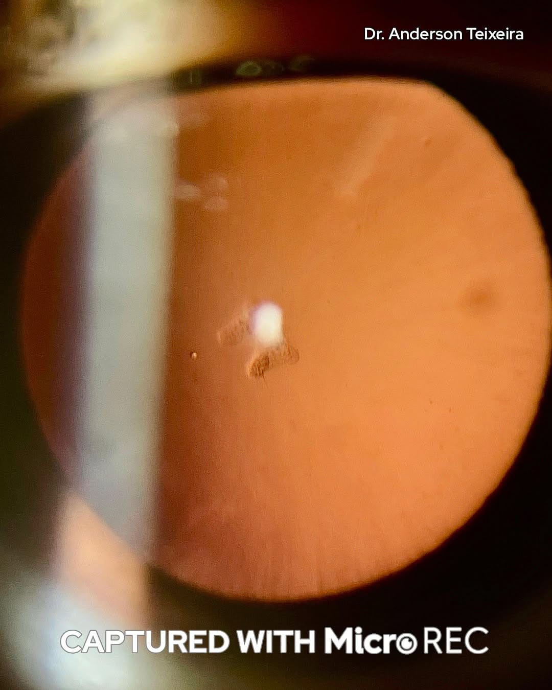 Post 2 by Custom Surgical on Instagram (image)