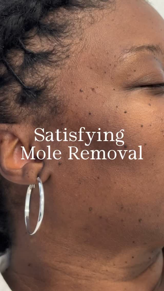 Post 8 by Dr. Ife Rodney | Eternal Dermatology & Aesthetic Center on Instagram (video)