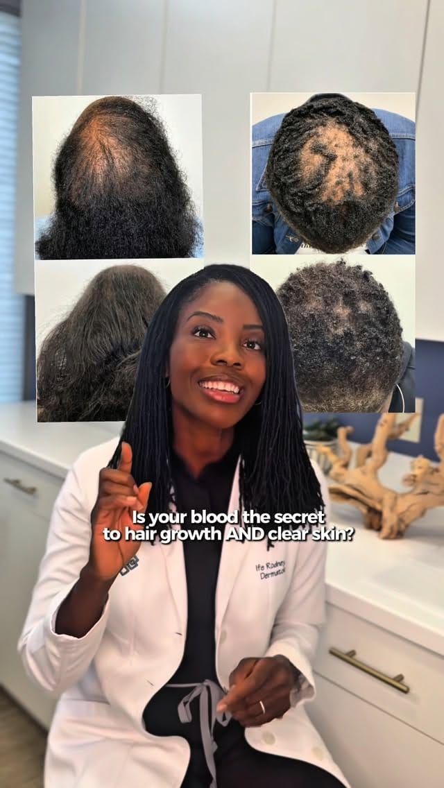 Post 7 by Dr. Ife Rodney | Eternal Dermatology & Aesthetic Center on Instagram (video)