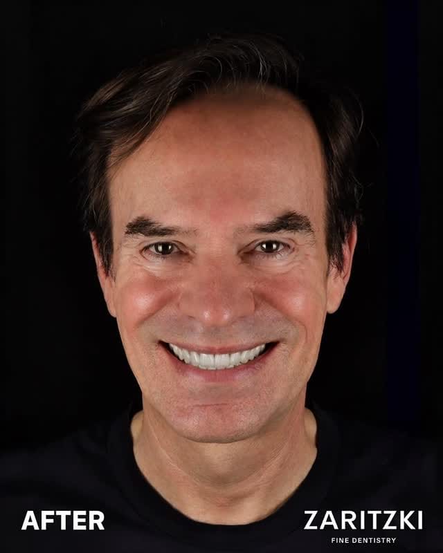 Post 5 by FELIX ZARITZKI FINE DENTISTRY on Instagram (video)