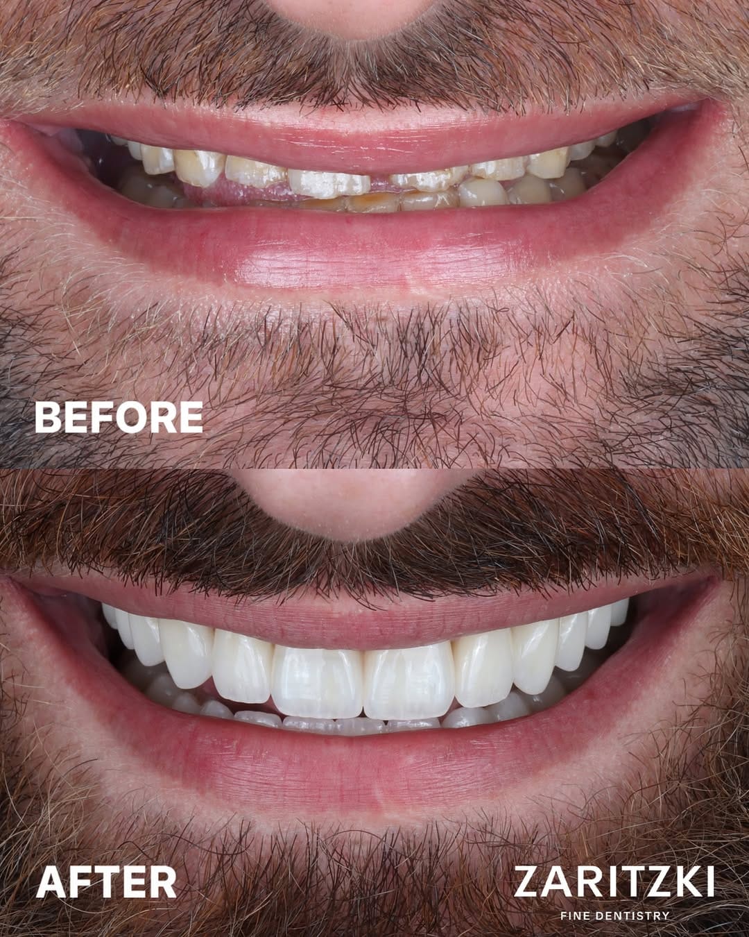 Post 4 by FELIX ZARITZKI FINE DENTISTRY on Instagram (carousel)