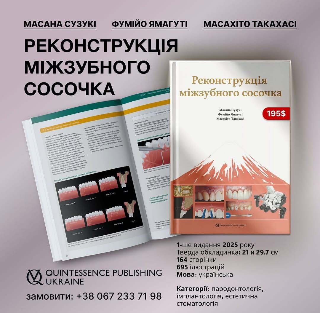 Post 3 by MegaGen_Ukraine 🇺🇦 on Instagram (image)