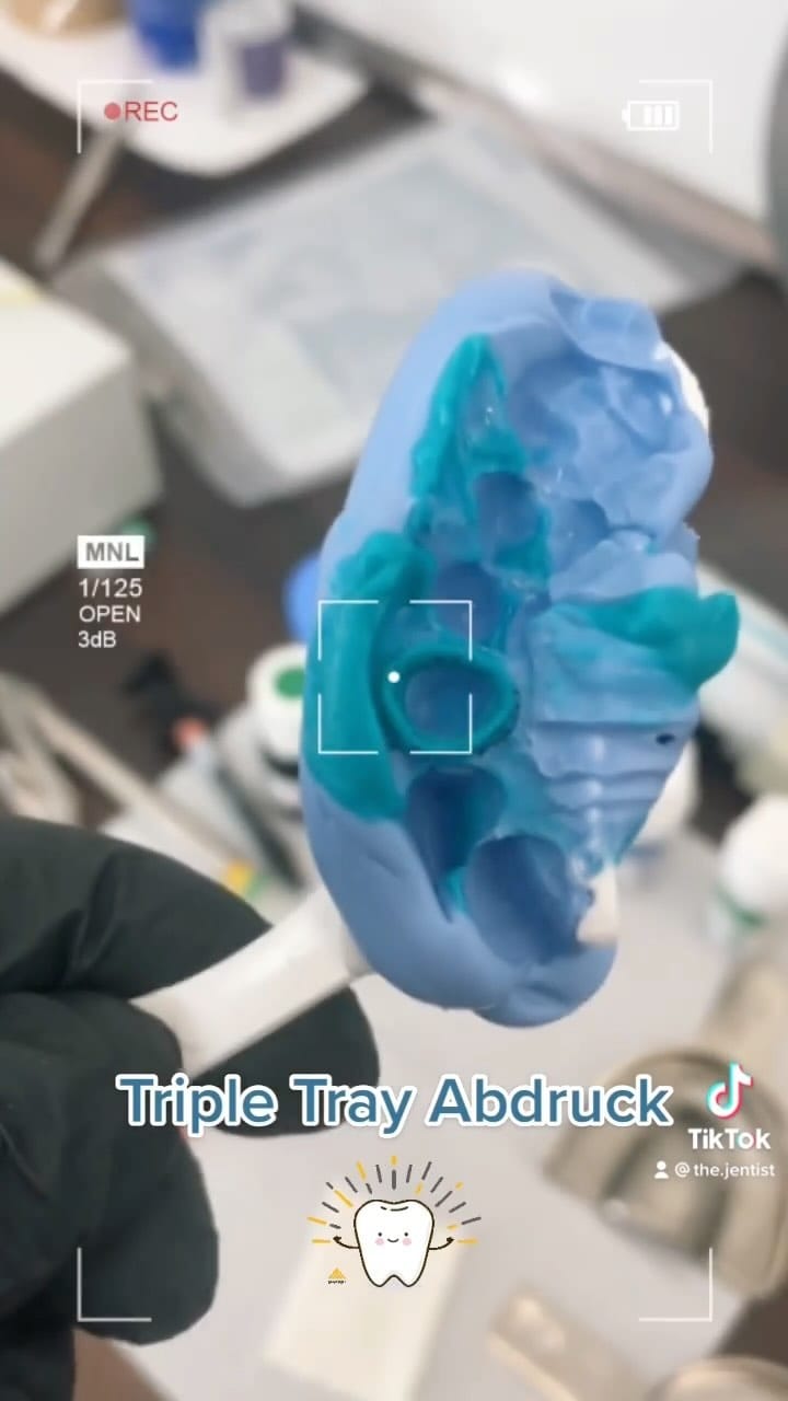 Post 9 by @the.jentist on Instagram (video)