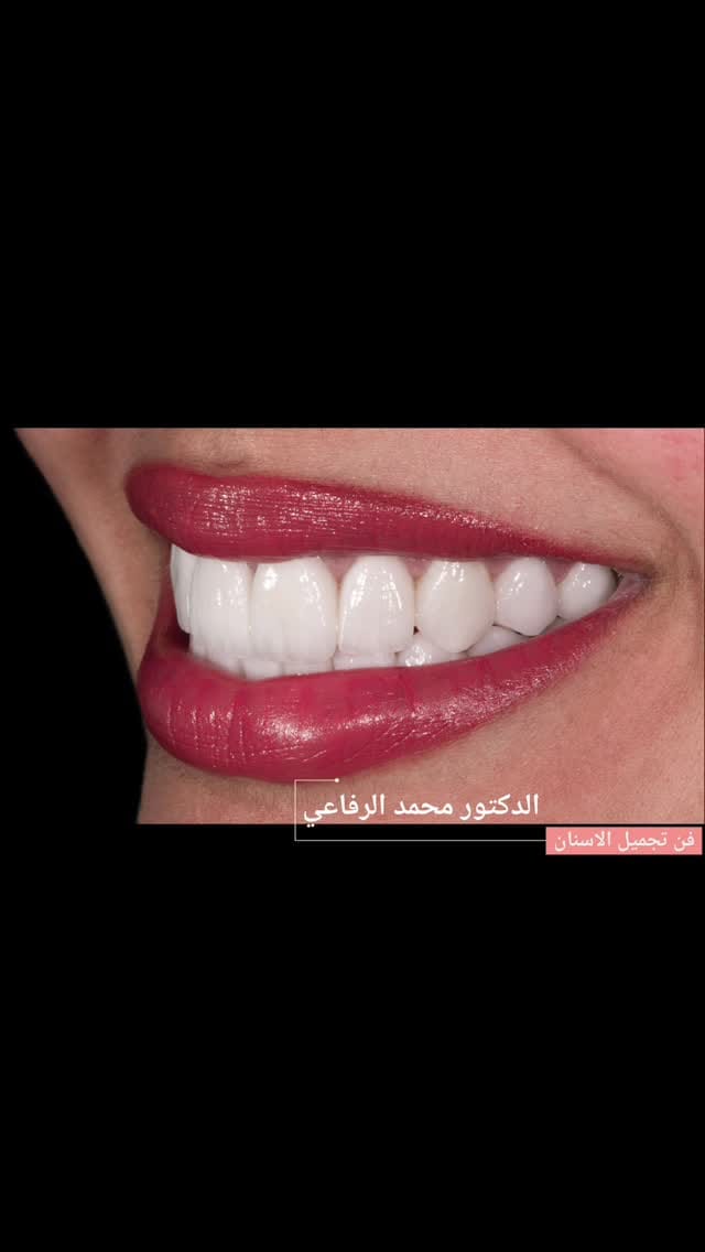Post 6 by Mohammad Al Rifai on Instagram (video)