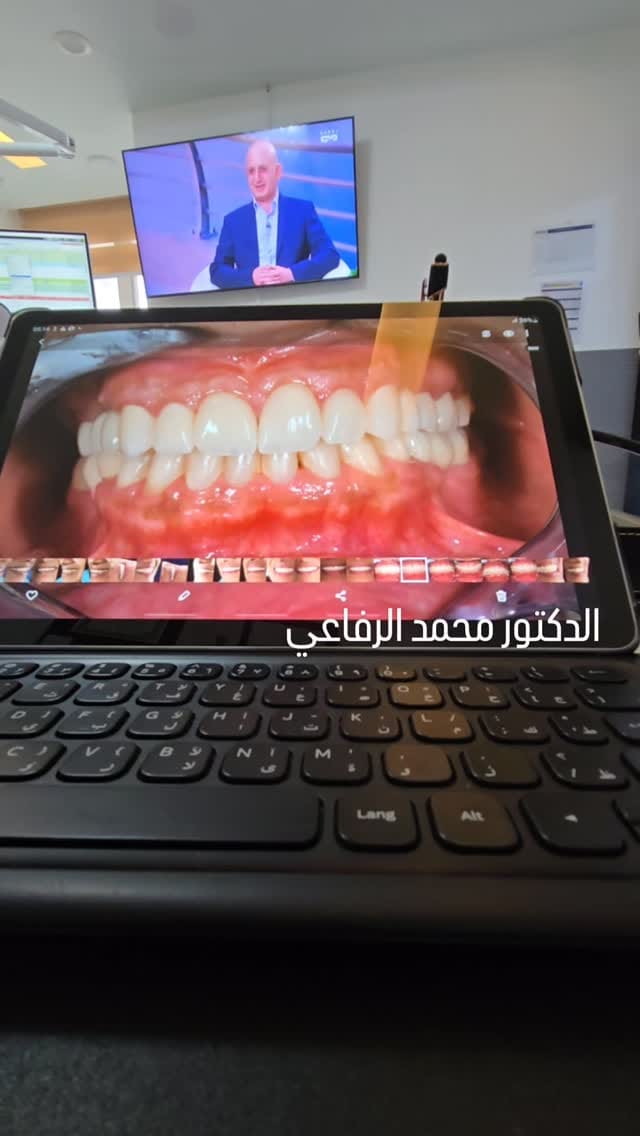Post 8 by Mohammad Al Rifai on Instagram (video)