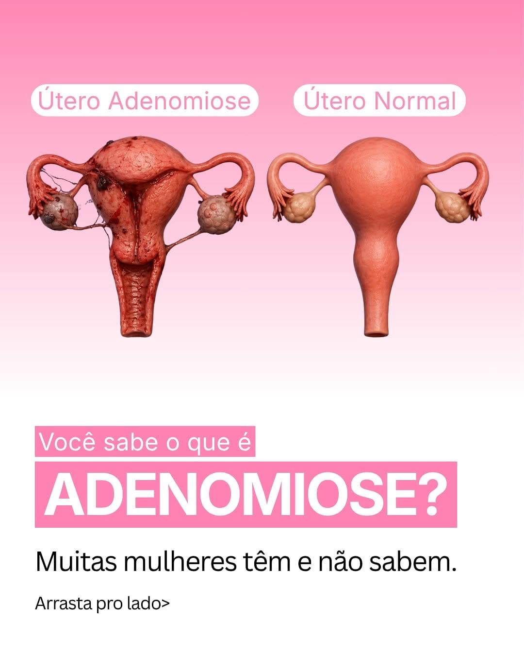 Post 1 by Clínica Espaço Mulher & Saúde on Instagram (carousel)