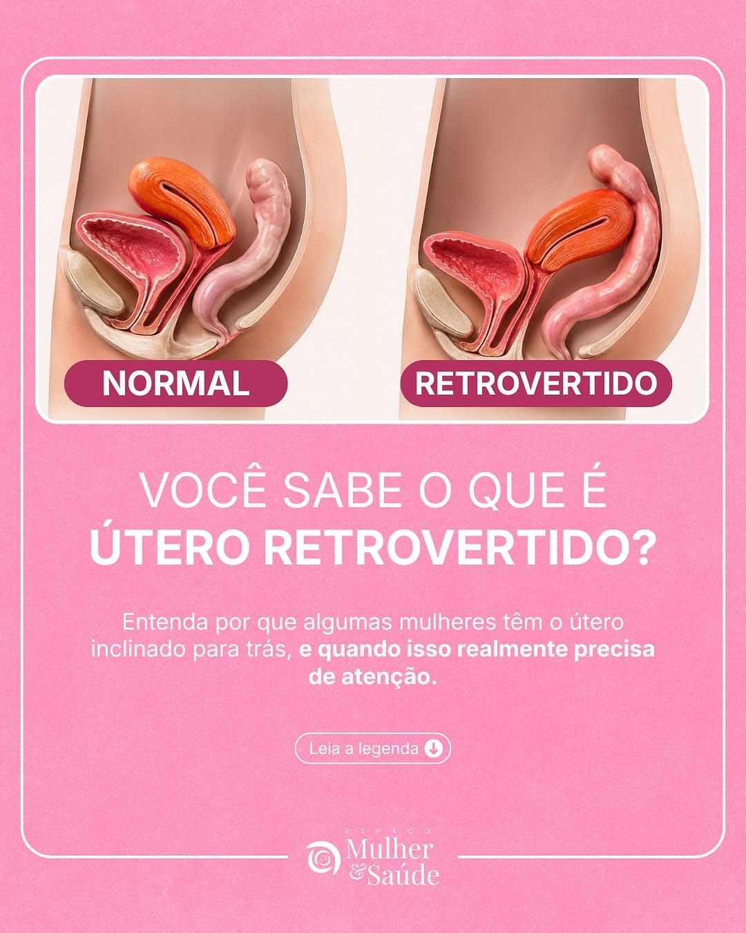 Post 3 by Clínica Espaço Mulher & Saúde on Instagram (image)