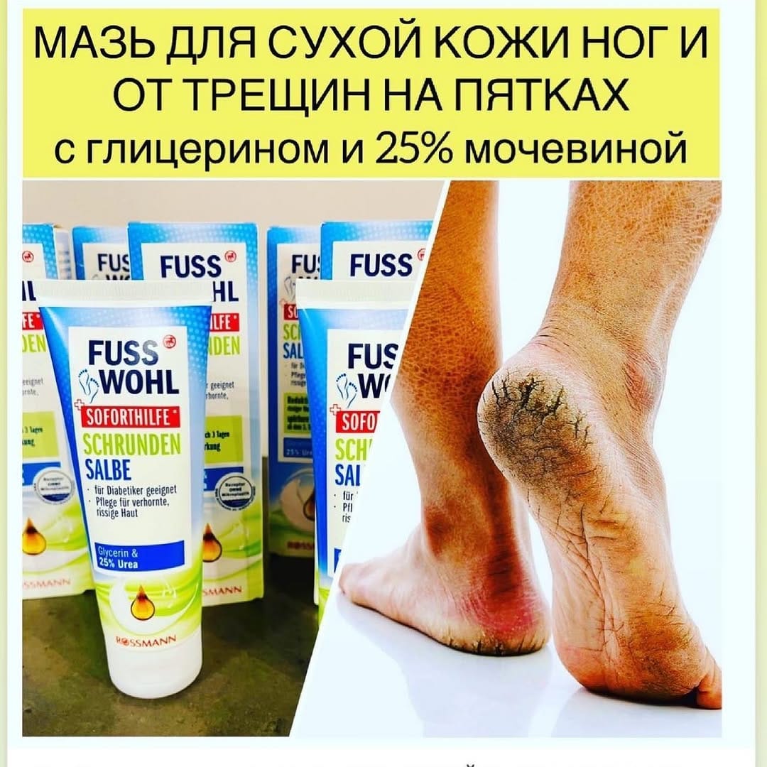 Post 8 by ВИТАМИНЫ КОСМЕТИКА из ГЕРМАНИИ on Instagram (image)